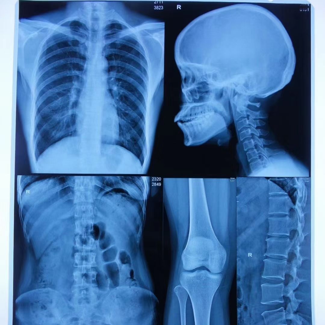 Medical X Ray Dry Thermal Printer Films_MRI_films - 副本