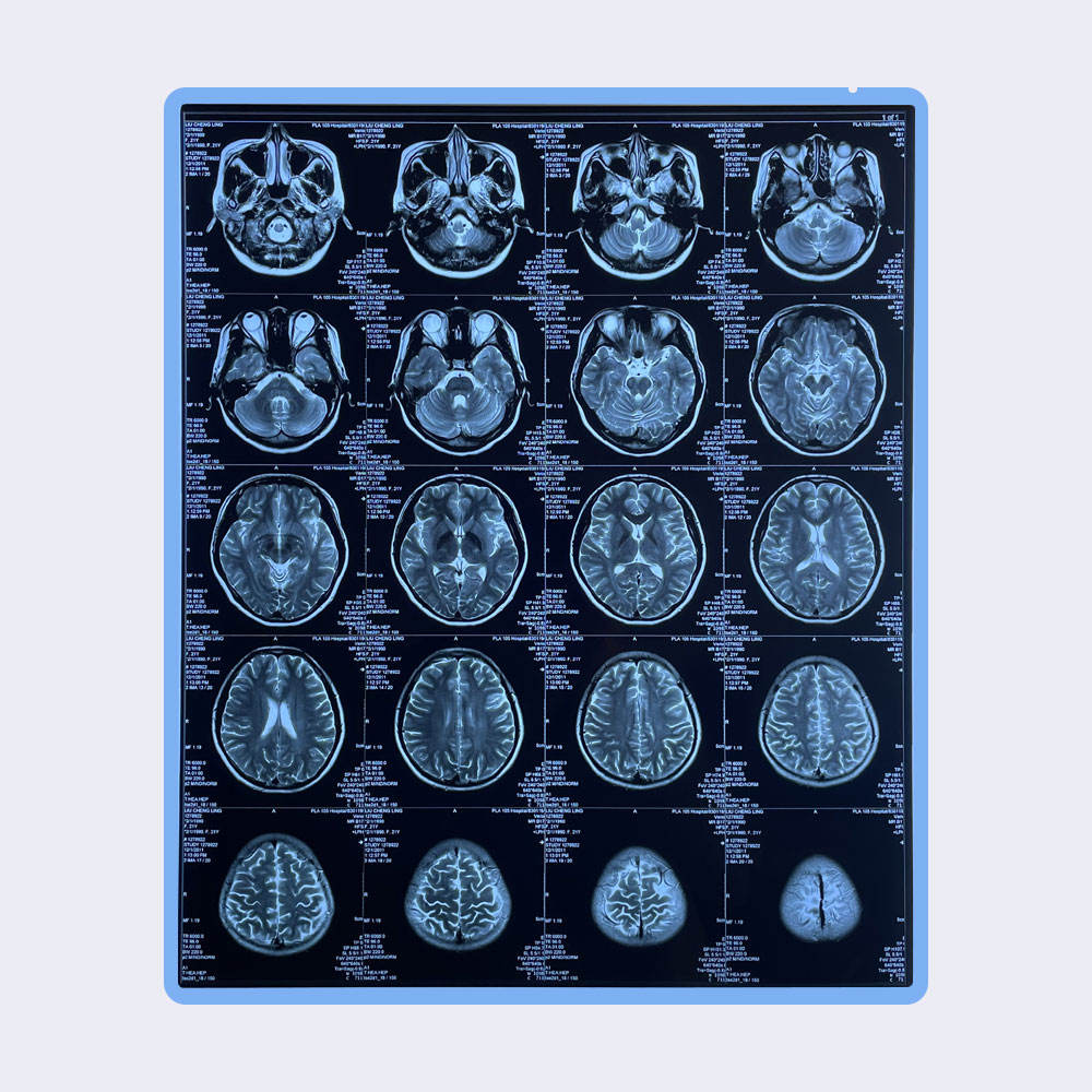 Medical X Ray Dry Thermal Printer Films